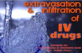 Extravasation & infiltration of iv drug