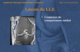 1 Institut de Chirurgie Orthopédique et Sportive  Lésion du LLE Contusion du compartiment médial.