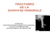 FRACTURES DE LA DIAPHYSE FEMORALE A.MENADI UNIVERSITEBADJI MOKHTAR-ANNABA FACULTE DEMEDECINE DEPARTEMENT DE MEDECINE.