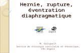 Hernie, rupture, éventration diaphragmatique M. Daligault Service de chirurgie vasculaire et thoracique, CHU Angers.