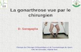La gonarthrose vue par le chirurgien D. Saragaglia Clinique de Chirurgie Orthopédique et de Traumatologie du Sport. CHU de Grenoble, Hôpital Sud.