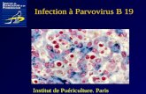Infection à Parvovirus B 19 Institut de Puériculture. Paris.