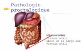 Pathologie proctologique Hémorroïdes fissure anale abcès de la marge anale fistule anale.