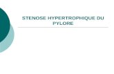 STENOSE HYPERTROPHIQUE DU PYLORE. Historique Premier cas décrit en 1888 Premier traitement chirurgical en 1907 Définition Hypertrophie des couches musculaires.