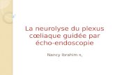 La neurolyse du plexus cœliaque guidée par écho-endoscopie Nancy Ibrahim R 2.
