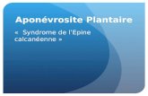 Aponévrosite Plantaire « Syndrome de lEpine calcanéenne »
