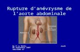Rupture danévrysme de laorte abdominale Dr P.Le Bléïs Jeudi 06 Septembre 2007 SAU/SAMU 47.