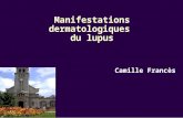 Manifestations dermatologiques du lupus Camille Francès.