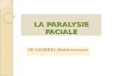 LA PARALYSIE FACIALE PR GHORBEL Abdelmoneem. DEFINITION Syndrome déficitaire moteur, sensitif, sensoriel et sécrétoire dans le territoire du nerf facial.