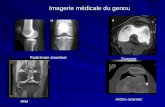 Imagerie médicale du genou Imagerie médicale du genou Radiologie standard IRM Scanner Arthro-scanner