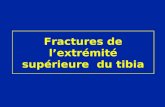 Fractures de lextrémité supérieure du tibia. Les fractures de lextrémité supérieure du tibia sont parfois complexes.