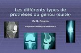 Les différents types de prothèses du genou (suite) Dr S. Costes Stephane.costes@ch-libourne.fr.