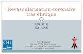 MR P. G 53 ANS Revascularisation coronaire Cas clinique Anne Daoudal Service CTCV CHU Rennes Journées du collège de chirurgie cardio- thoracique et vasculaire.