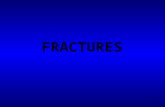 1 FRACTURES. 2 FRACTURE OS CORTICO- DIAPHYSAIRE Diagnostic clinique d une fracture os long aisé -> radios pour préciser type de fracture sauf cas particuliers.