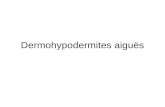 Dermohypodermites aiguës. Classification anatomopathologique.