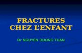 FRACTURES CHEZ LENFANT Dr NGUYEN DUONG TUAN. I. GENERALITE Les fractures de lenfant sont différentes de celles de ladulte car : Les fractures de lenfant.