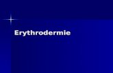 Erythrodermie. DIAGNOSTIC Syndrome rare Syndrome rare –érythème confluant associé –à une desquamation touchant l'ensemble des téguments (plus de 90 p.