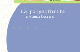 La polyarthrite rhumatoïde. POLYARTHRITE RHUMATOÏDE 0,8% population 6 F / 4H 50 ans Origine ? Auto I, F familiaux, environnement…