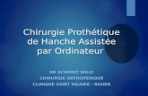 Chirurgie Prothétique de Hanche Assistée par Ordinateur DR SCHMIDT WILLY CHIRURGIE ORTHOPEDIQUE CLINIQUE SAINT HILAIRE - ROUEN.