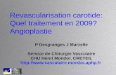 Revascularisation carotide: Quel traitement en 2009? Angioplastie P Desgranges J Marzelle Service de Chirurgie Vasculaire CHU Henri Mondor, CRETEIL .
