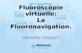 FREDERIC FOUQUET Fluoroscopie virtuelle: La Fluoronavigation