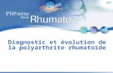 Diagnostic et évolution de la polyarthrite rhumatoïde.