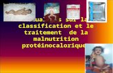 Actualités sur la classification et le traitement de la malnutrition protéinocalorique.