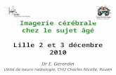 Imagerie cérébrale chez le sujet âgé Lille 2 et 3 décembre 2010 Dr E. Gerardin Unité de neuro radiologie, CHU Charles Nicolle, Rouen.