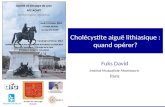 Société de Chirurgie de Lyon Fuks David Institut Mutualiste Montsouris Paris Cholécystite aiguë lithiasique : quand opérer?
