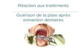 Réaction aux traitements Guérison de la plaie après extraction dentaires.