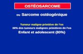 OSTÉOSARCOME ou Sarcome ostéogénique Tumeur maligne primitive de los 30% des tumeurs malignes primitives de los Enfant et adolescent (80%)