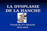 LA DYSPLASIE DE LA HANCHE Travail de 2 ème doctorat 2003-2004.