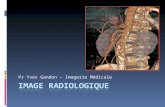 Pr Yves Gandon – Imagerie Médicale. Radiologie Radiographies Standard Avec opacification Scanner Angiographies Echographie Imagerie par résonance magnétique.