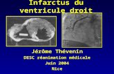 Infarctus du ventricule droit Jérôme Thévenin DESC réanimation médicale Juin 2004 Nice.