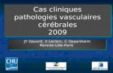 Cas cliniques pathologies vasculaires cérébrales 2009 JY Gauvrit, X Leclerc, C Oppenheim Rennes-Lille-Paris Rennes-Lille-Paris.