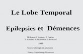 Le Lobe Temporal Epilepsies et Démences M.Braun, S Kremer, F Cattin, E Schmitt, R.Anxionnat, S. Bracard 2009 Neuroradiologie et Anatomie Nancy, Strasbourg,