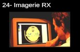 24- Imagerie RX. Les points essentiels Atténuation des rayons X Couche de demi-atténuation Image radiologique Contraste radiologique Tomographie assistée.