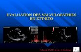EVALUATION DES VALVULOPATHIES EN ETT/ETO Dr Franck HAZIZA. Service de Cardiologie.