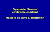Dysplasie fibreuse et fibrome ossifiant Maladie de Jaffé-Lichtenstein.