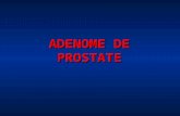 ADENOME DE PROSTATE. A quoi sert une prostate? envoie dans le canal éjaculateur un liquide blanc qui aide les spermatozoïdes à se déplacer. Et les vésicules.