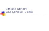Lithiase Urinaire Cas Clinique (2 cas). Mme ROUZ 37 ans lombalgies chroniques Dt depuis 5 ans infections urinaires r©cidivantes palpation lombaire non