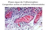 Phase aigue de l’inflammation: Congestion active et œdème inflammatoire.