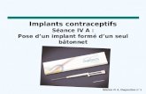 Séance IV A, Diapositive n o 1 Implants contraceptifs Séance IV A : Pose d’un implant formé d’un seul bâtonnet.