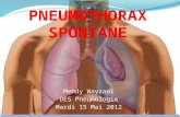 Pneumothorax spontane
