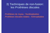 2008 Techniques de non-fusion : prothèses discales