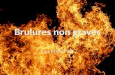Brulures non graves
