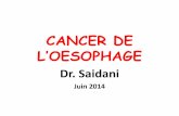 Cancer de l oesophage (1)