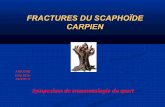 Fractures du scaphoïde