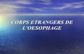 Corps étranger oesophagien