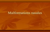 Malformation nasale